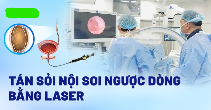 Thông báo mời chào giá Hệ thống tán sỏi niệu quản ngược dòng công nghệ Laser